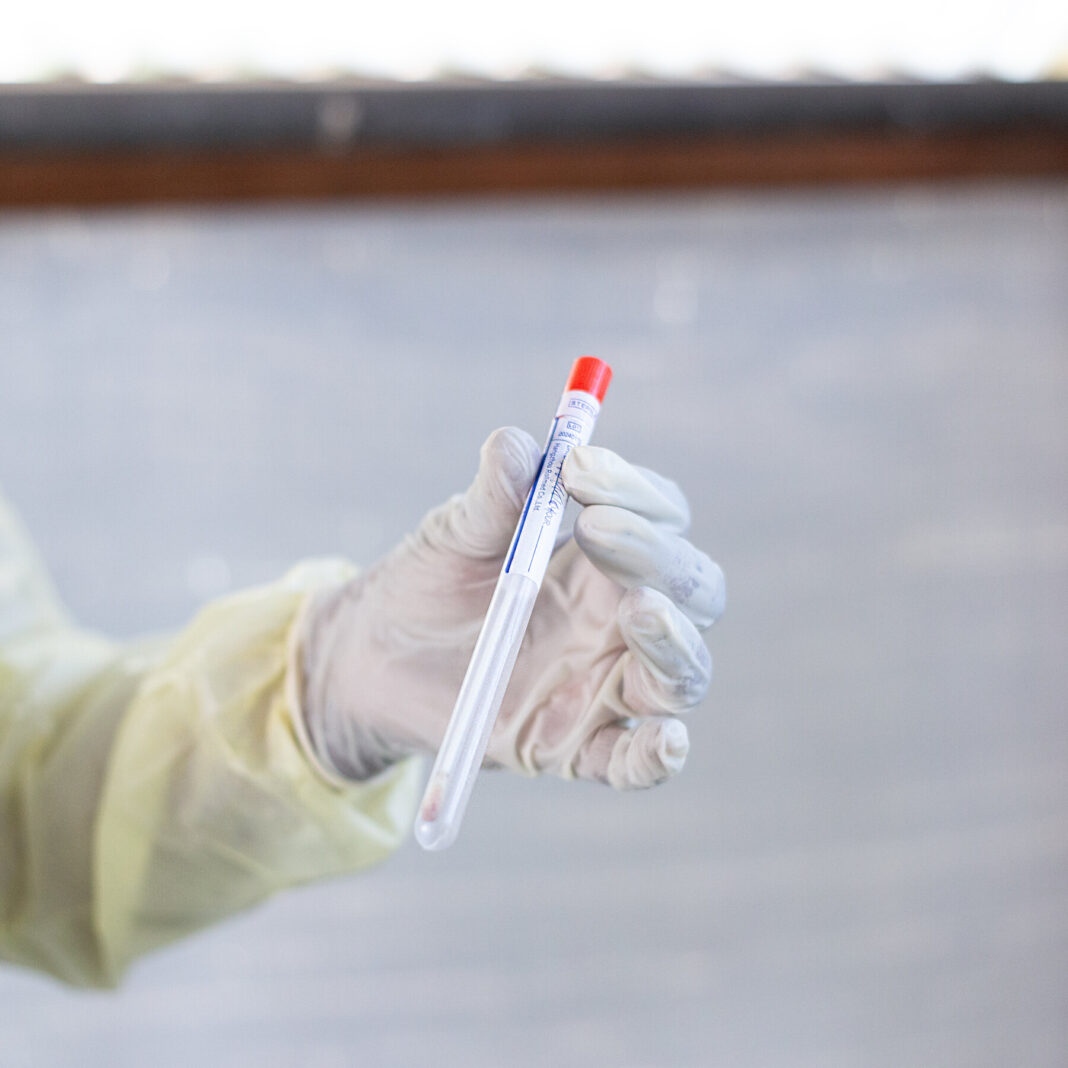 Dutch Virologist Charged With Conspiracy to Smuggle Mpox Virus Into United States