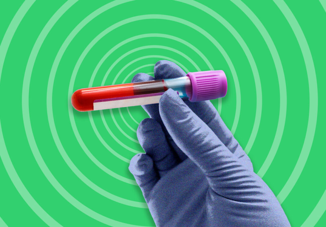 A New Blood Test for Colon Cancer Is Here—But It’s Still No Match for the Screening You’re Avoiding