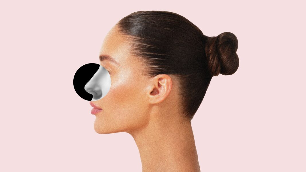 My Revision Rhinoplasty Before & After Photos: Fixing My Nose Job