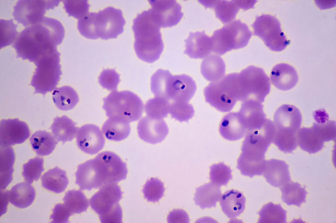 Drug-Resistant Malaria Mutation Boosts Survival and Spread, Study Warns