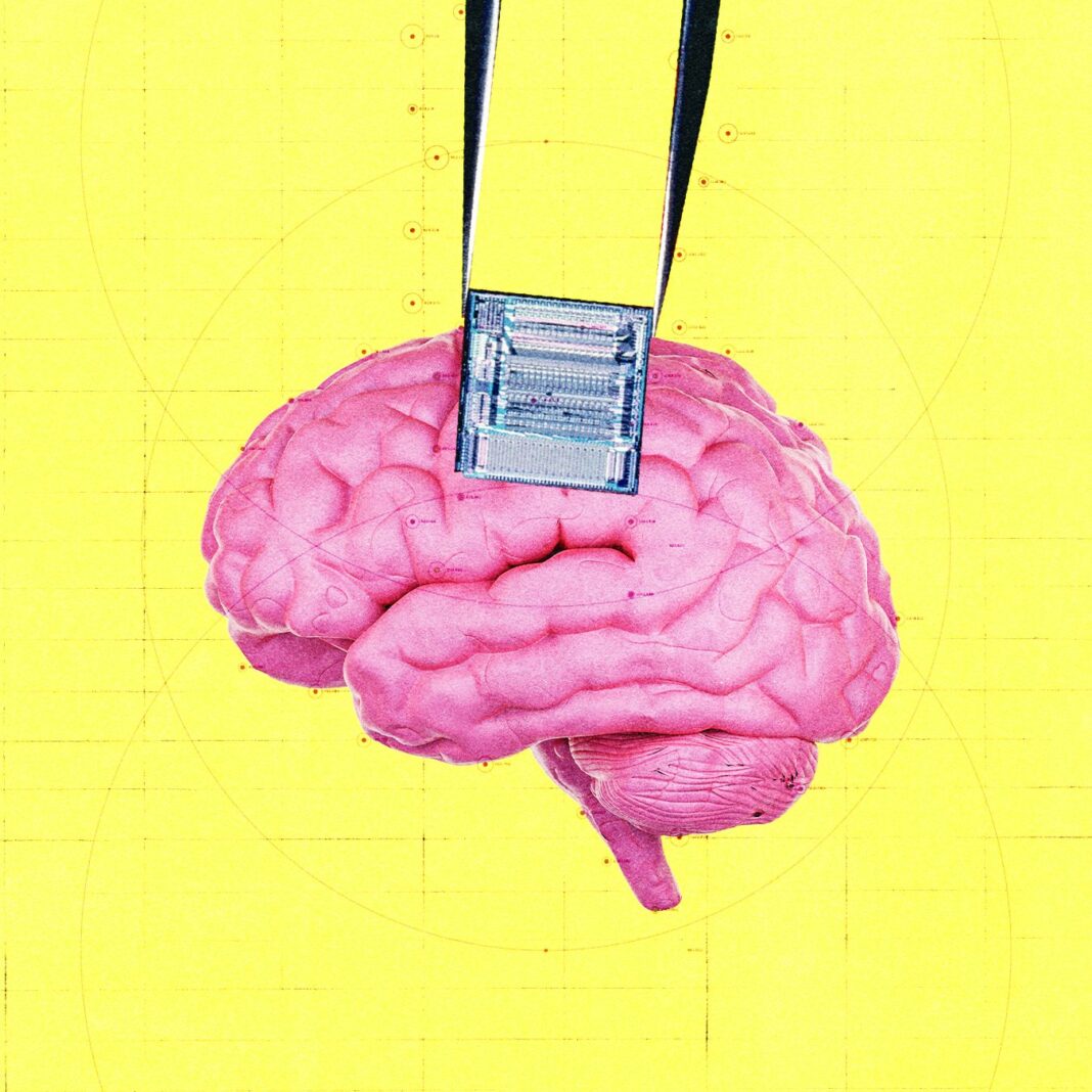 OpenAI Backs Brain Implant Startup Using AI to Detect Cancer Early