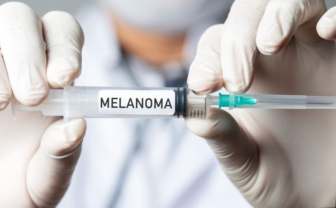 New mRNA Vaccine Cuts Melanoma Recurrence Risk by More Than 40 Percent